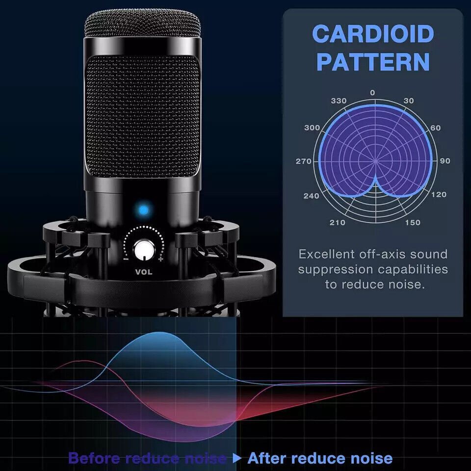Professional USB Streaming Microphone Kit – Cardioid Condenser Mic for Podcasting, Gaming, Live Streaming & Recording